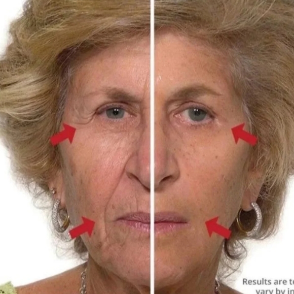 Plexaderm Rapid Reduction Serum Advanced Formula TVs best seller for fine lines - Picture 5 of 8